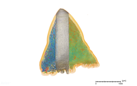 Tri-contrast imaging of Drum Fish tooth Tri-contrast imaging of Drum Fish tooth